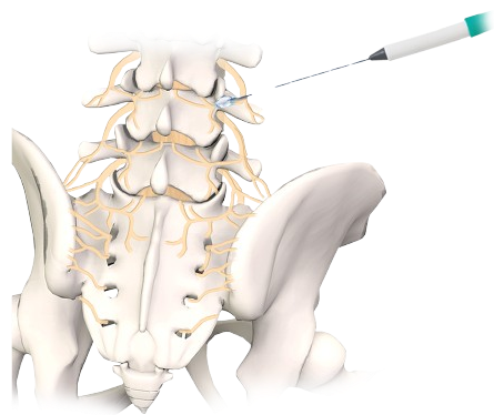 Cryoprobe_mechanism-removebg-preview